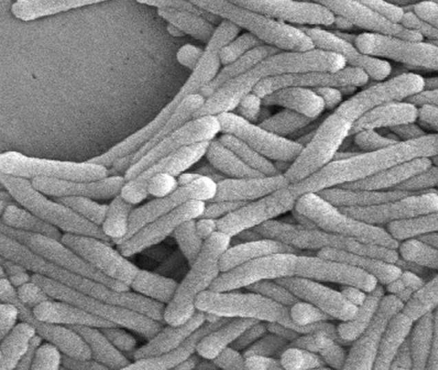 Legionella powiększenie 1200x